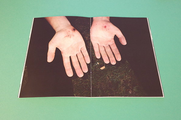 An open magazine shows a photograph of two open palms facing upwards. Both hands have small, red sores on the palms and are set against a dark, grassy background.