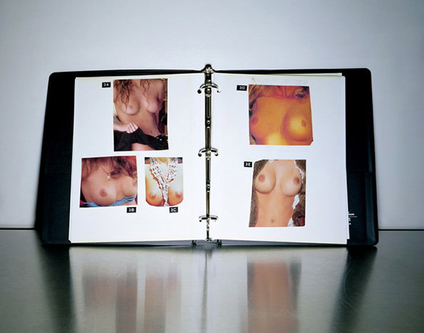 An open black binder displays several photographs of a person’s chest. The images are arranged on white pages and labelled with codes such as “3A” and “3E”.