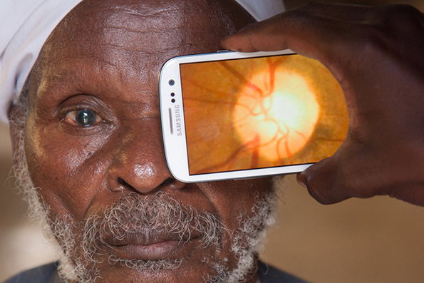Retinal-imaging-by-Peek_5--¬-Image-courtesy-of-Peek.jpg