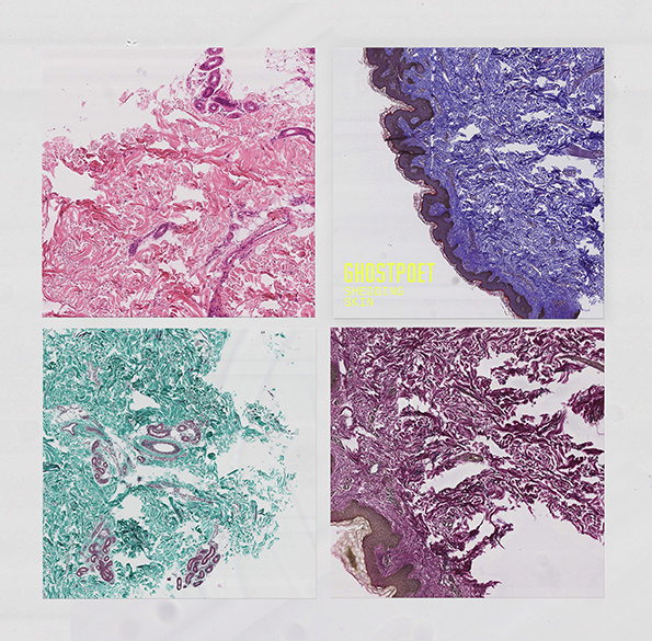 ghospoet-shedding-skin-int-1.png