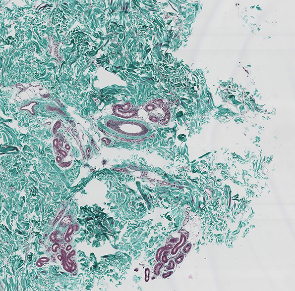 ghospoet-shedding-skin-int-2.png