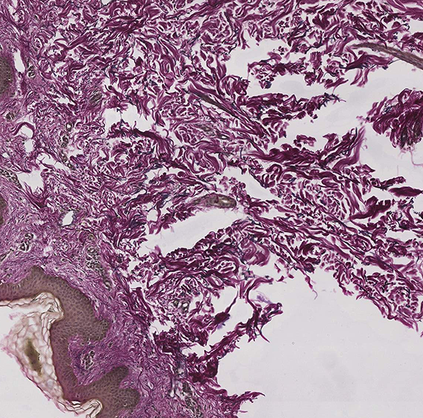 ghospoet-shedding-skin-int-5.png