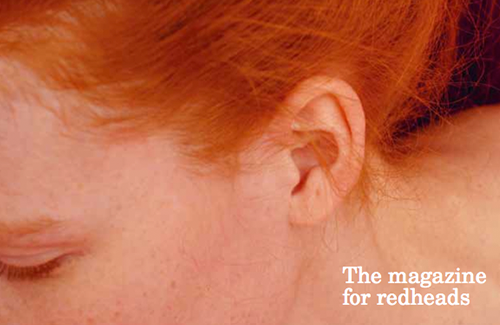 MC1R, a magazine specifically for and about redheads