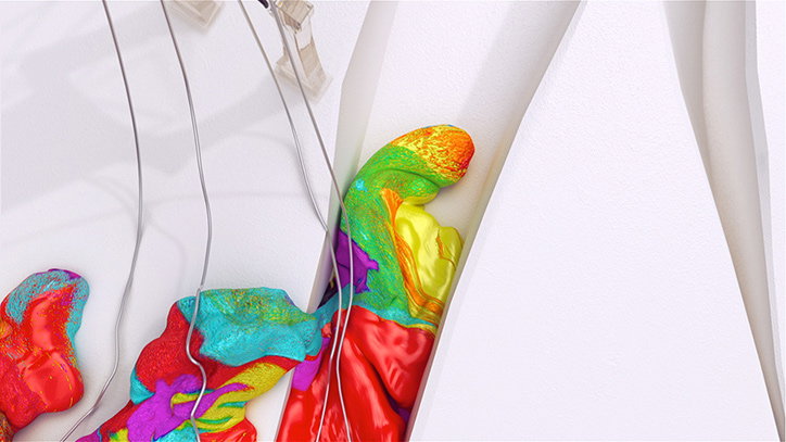 A colourful, multi-hued sculpture of a figure is squeezed into a narrow gap between white, architectural walls. Thin metal wires extend from the top of the frame, connecting to the figure.