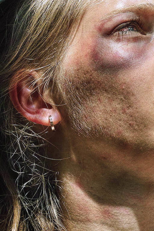 Satoshi_Fujiwara__Police__Cover-up__Demonstrations__Brutality_Photography_Police_Horse_Germany_Polizei_4_bruise.jpg
