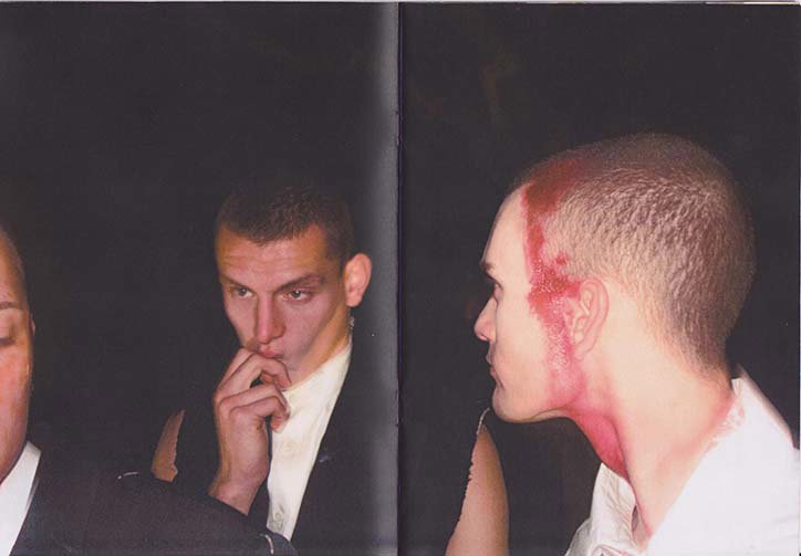 A diptych of two photographs showing a person with a buzzed haircut against a dark background. In the first, they look at the camera with a hand to their chin; in the second, a profile view shows red makeup smeared across their cheek and neck.