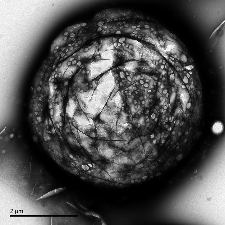 Microbubble-for-drug-delivery-Estelle-Beguin-photography-itsnicethat.png