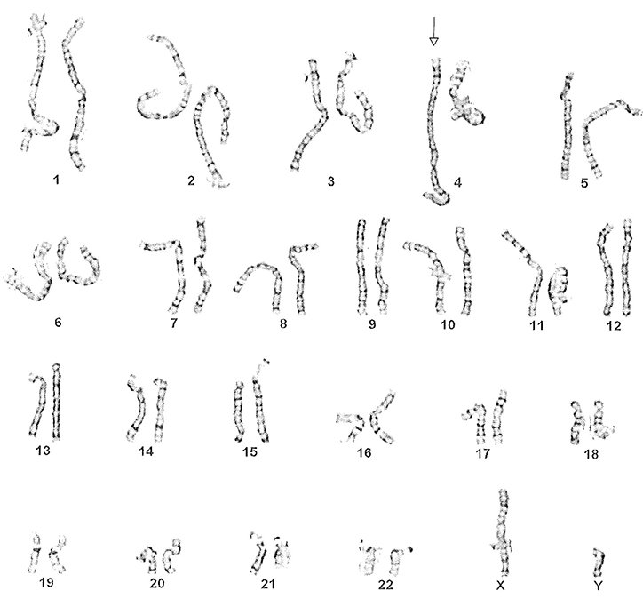 Lennarts_DeBruijn-ChromosomalAbnormalities-Graphicdesign-itsnicethat-06.jpg