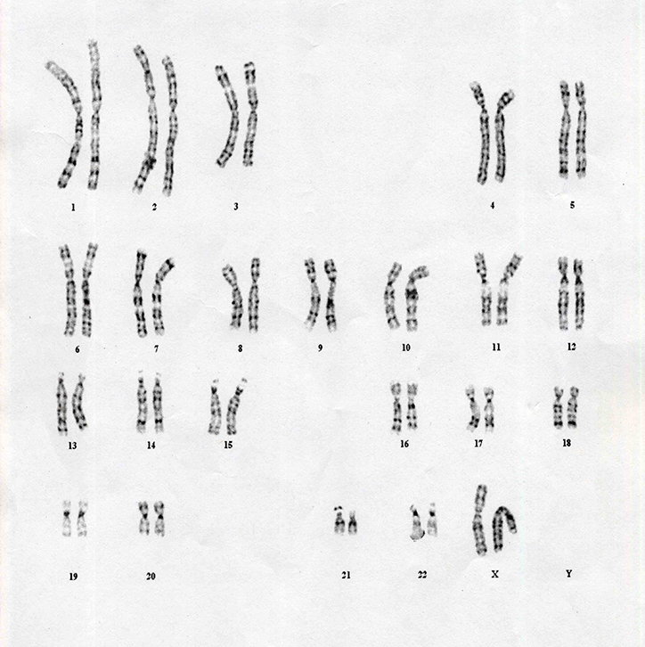 Lennarts_DeBruijn-ChromosomalAbnormalities-Graphicdesign-itsnicethat-07.jpg