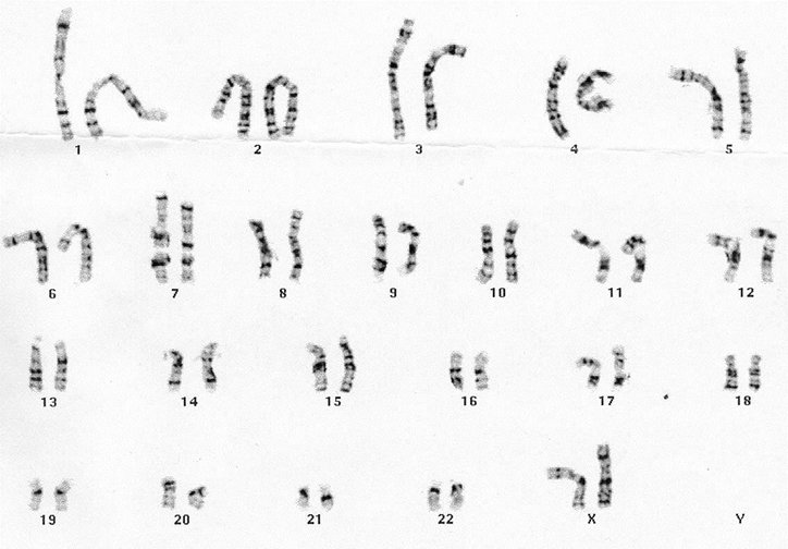Lennarts_DeBruijn-ChromosomalAbnormalities-Graphicdesign-itsnicethat-08.jpg