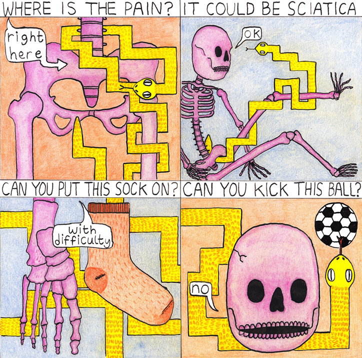 Sciatica.jpg