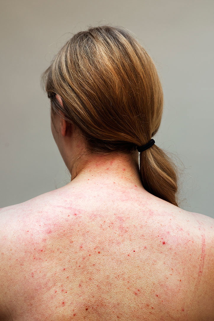 Sophie-Harris-Taylor_Epidermis_photography_itsnicethat_AMY2.jpg