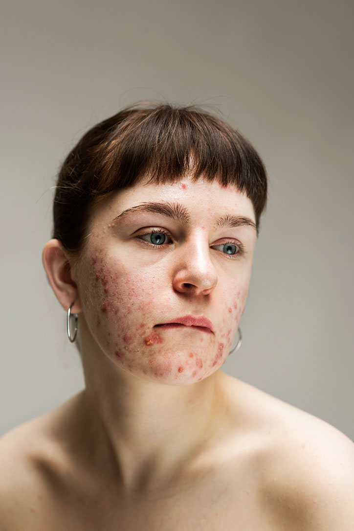Sophie-Harris-Taylor_Epidermis_photography_itsnicethat_ANNIE.jpg