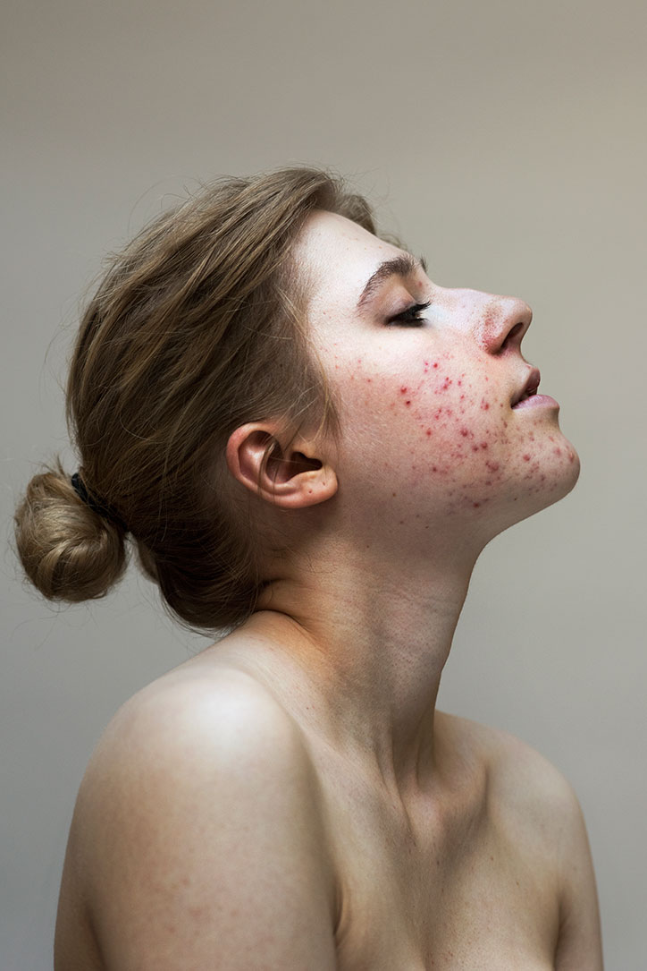 Sophie-Harris-Taylor_Epidermis_photography_itsnicethat_CHARLOTTE-R.jpg