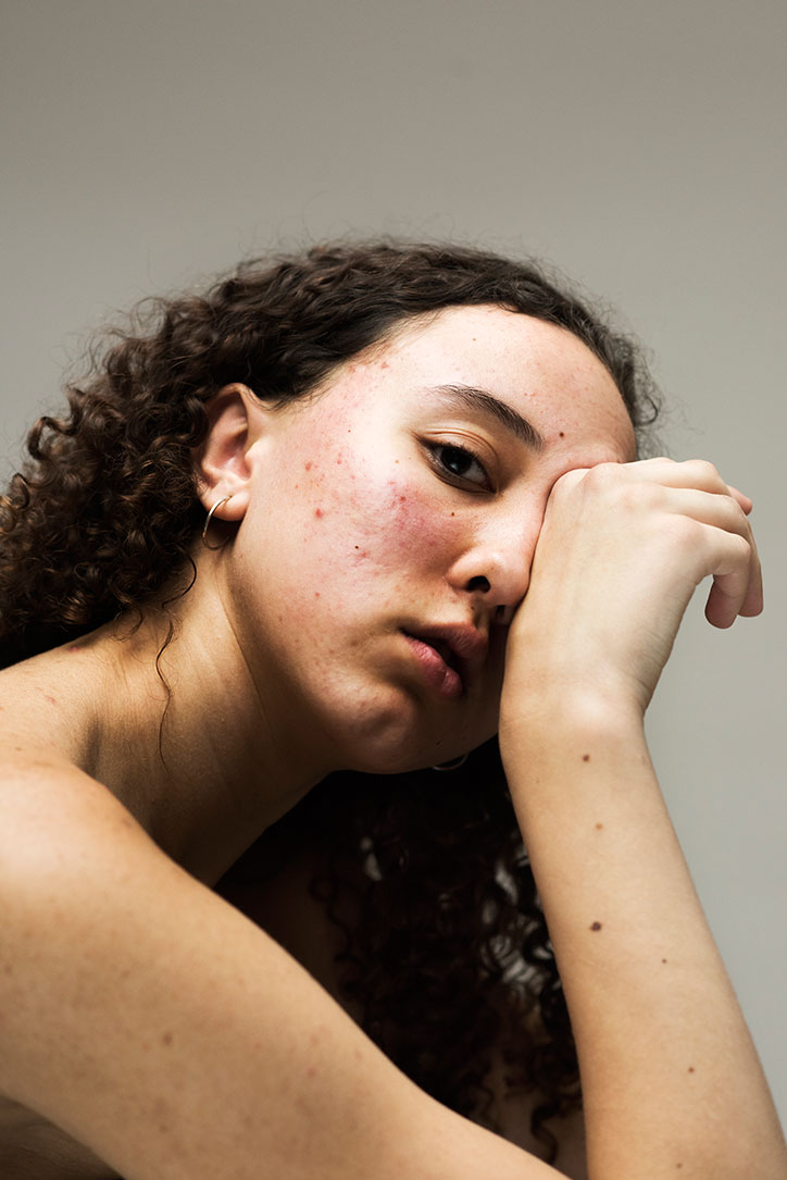 Sophie-Harris-Taylor_Epidermis_photography_itsnicethat_FRANCESCA.jpg