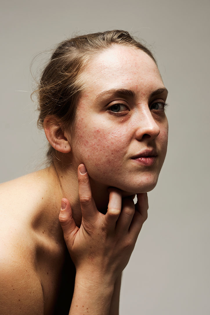Sophie-Harris-Taylor_Epidermis_photography_itsnicethat_GEORGIA.jpg