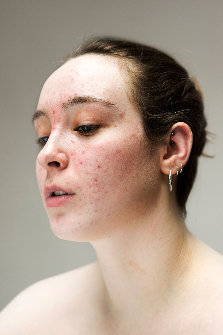 Sophie-Harris-Taylor_Epidermis_photography_itsnicethat_GINA.jpg