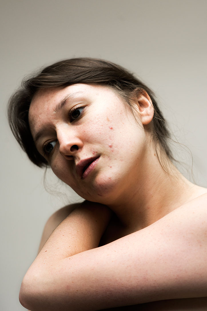 Sophie-Harris-Taylor_Epidermis_photography_itsnicethat_HANNAH.jpg