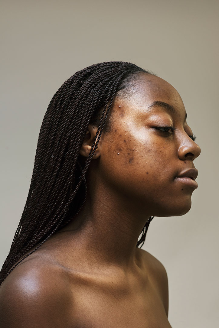Sophie-Harris-Taylor_Epidermis_photography_itsnicethat_HOLY.jpg