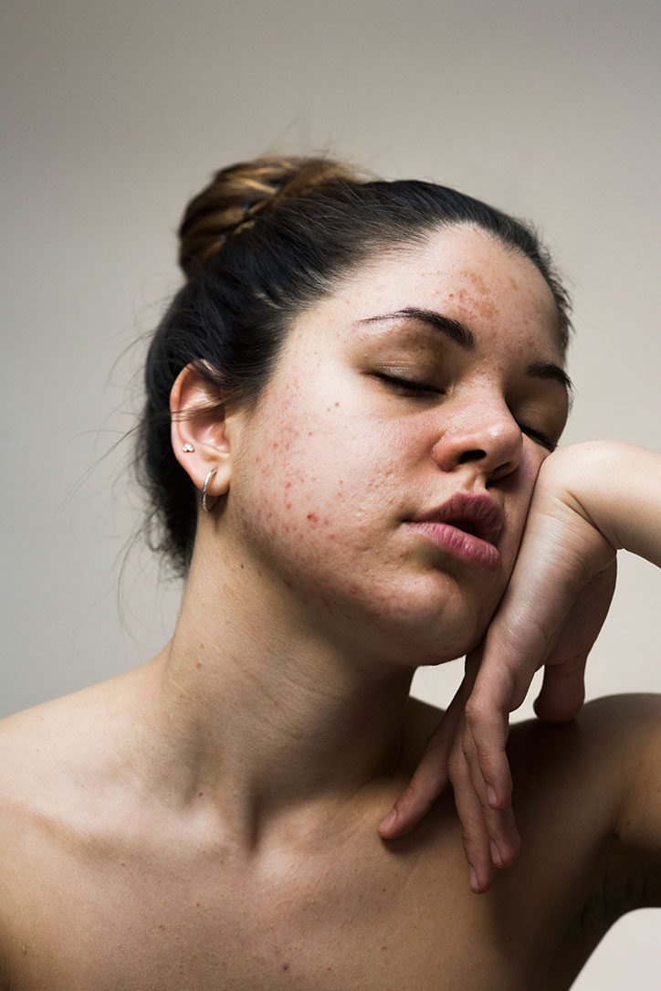 Sophie-Harris-Taylor_Epidermis_photography_itsnicethat_ILARIA.jpg