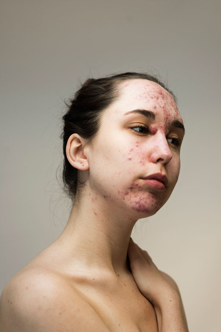 Sophie-Harris-Taylor_Epidermis_photography_itsnicethat_INDIANA.jpg