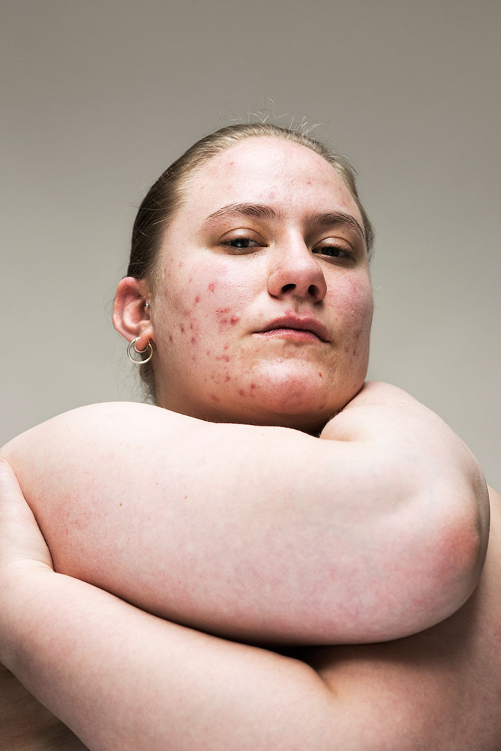 Sophie-Harris-Taylor_Epidermis_photography_itsnicethat_IZZY.jpg