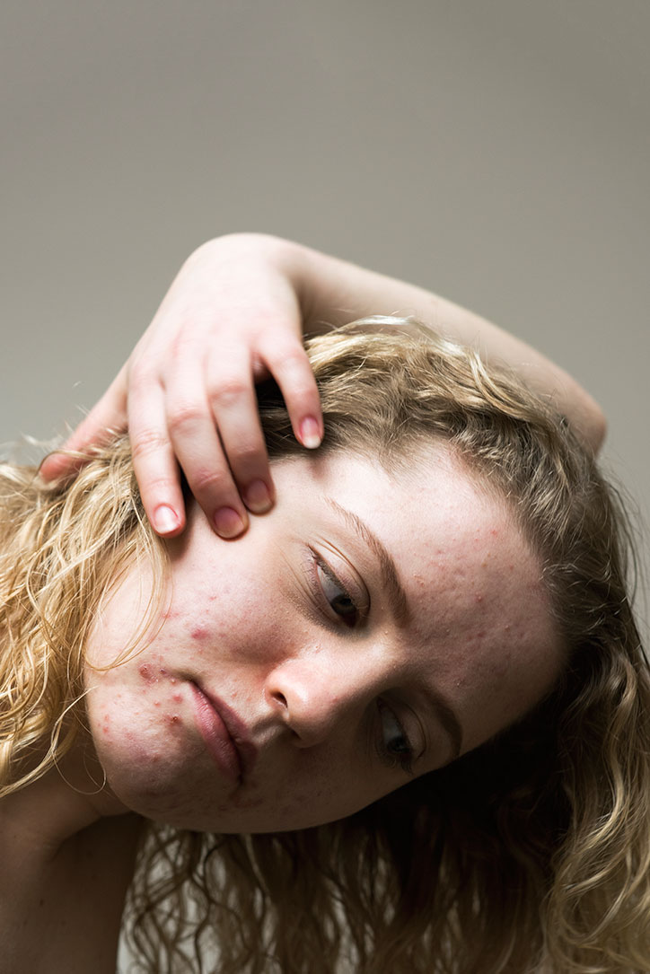 Sophie-Harris-Taylor_Epidermis_photography_itsnicethat_LOUISE.jpg