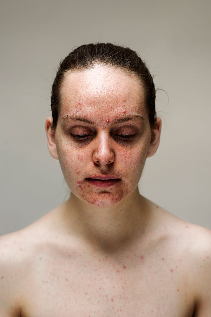 Sophie-Harris-Taylor_Epidermis_photography_itsnicethat_SARAH-1.jpg