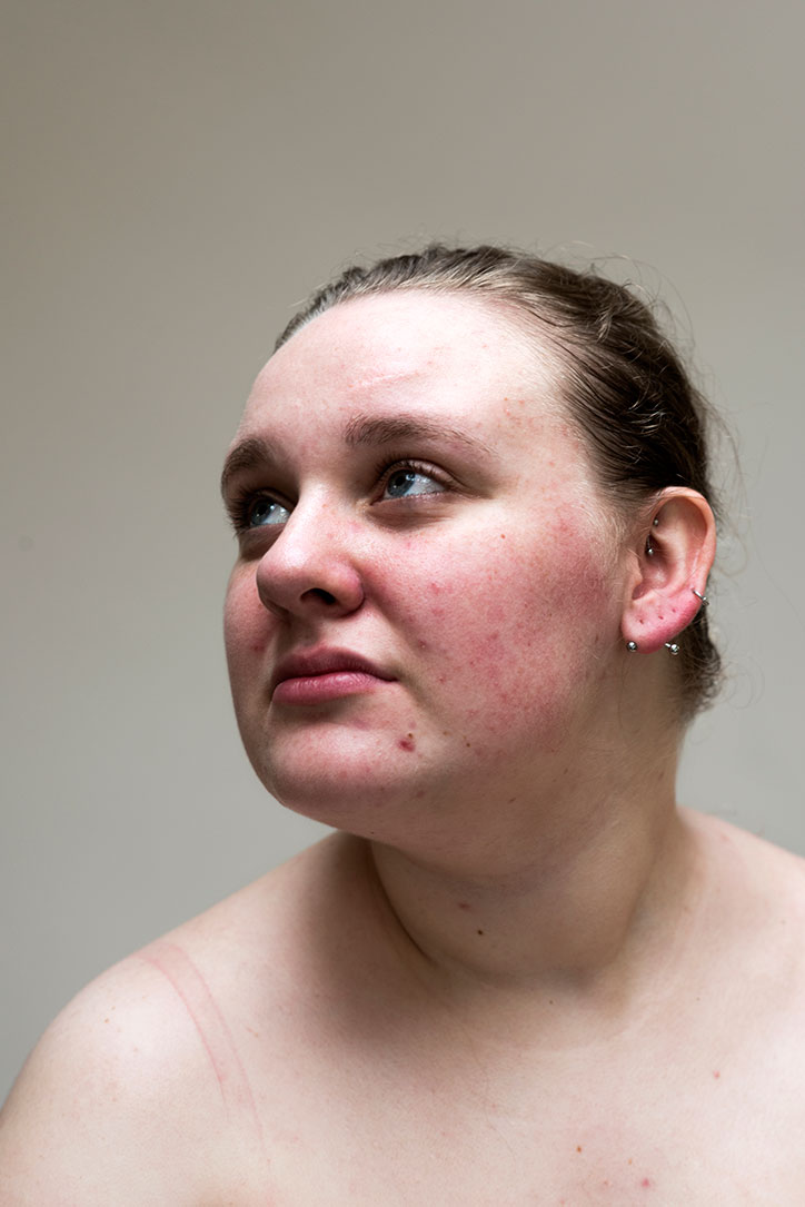 Sophie-Harris-Taylor_Epidermis_photography_itsnicethat_SOPHIE.jpg