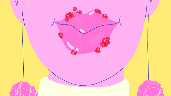 CaitlynMcCarthy-Coldsore-Animation-itsnicethat-07.gif