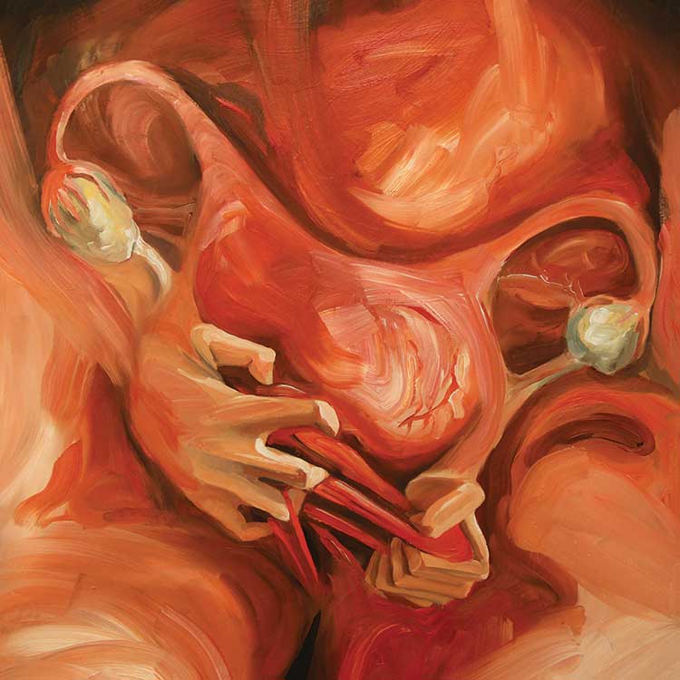 14 artists visualise endometriosis pain in a new campaign #painstories