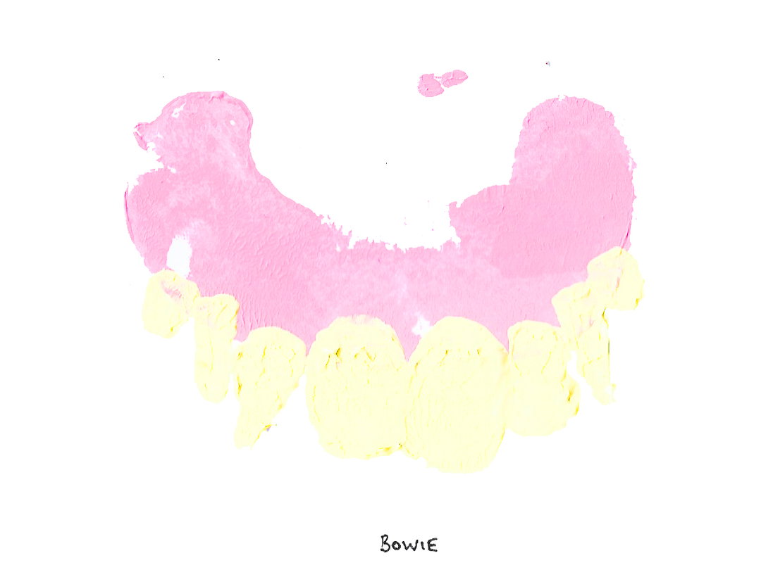 JamesO'Brien-PotatoDentures-Bowie-Art-itsnicethat.jpg
