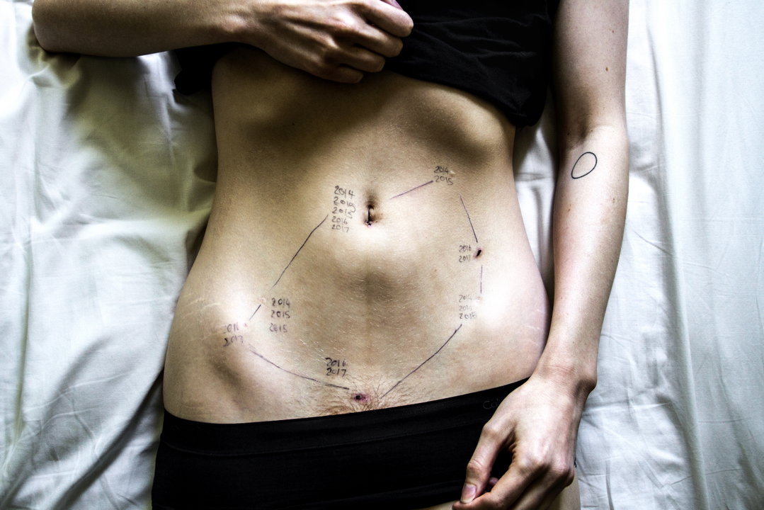 georgie-wileman--this-is-endometriosis-photography-itsnicethat-01.jpg