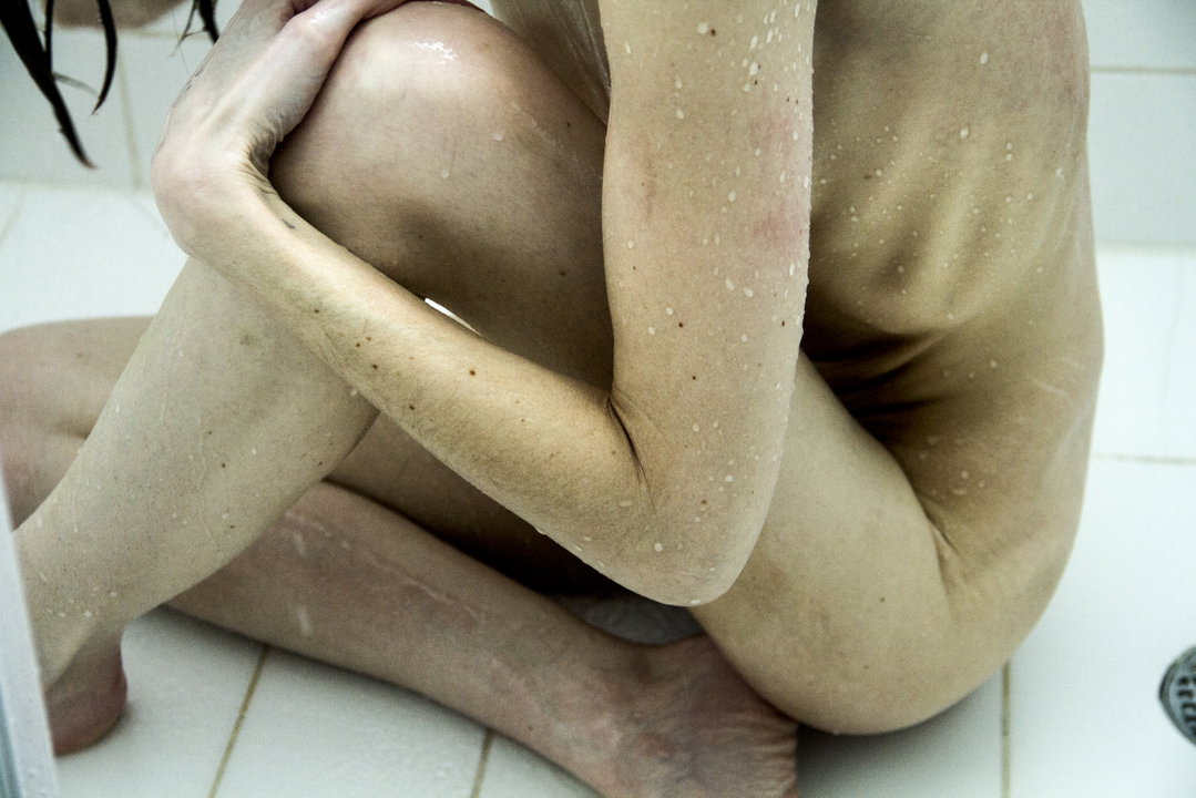 georgie-wileman--this-is-endometriosis-photography-itsnicethat-06.jpg