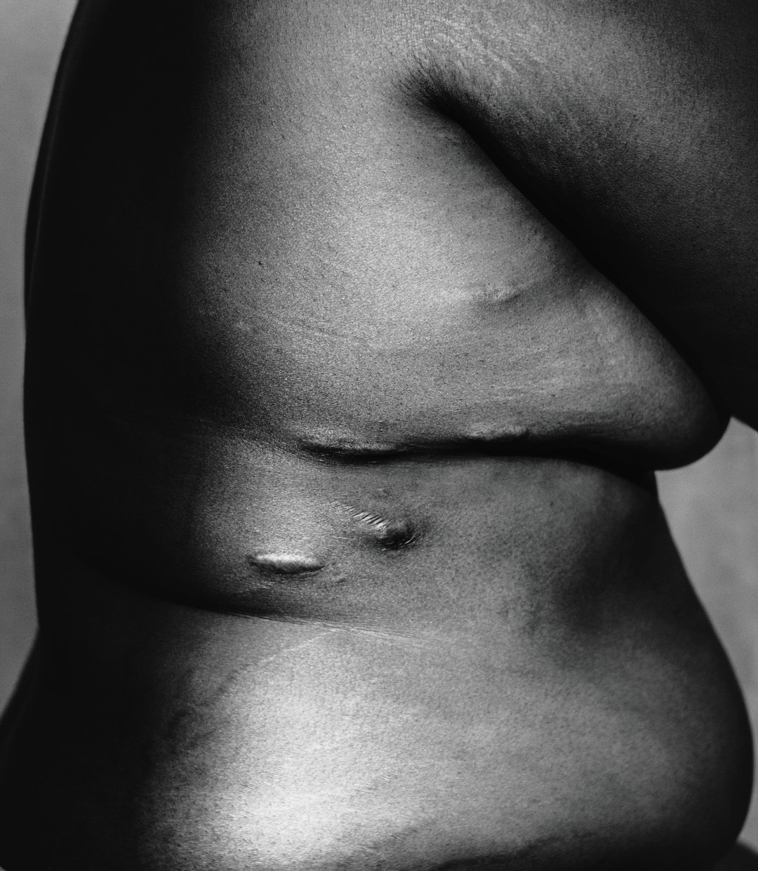georgie-wileman--this-is-endometriosis-photography-itsnicethat-09.jpg