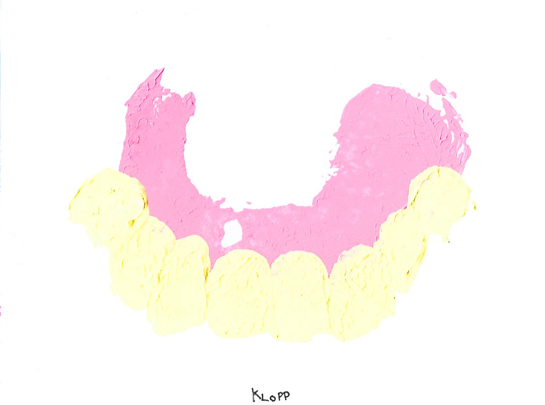 JamesO'Brien-PotatoDentures-JurgenKlopp-Art-itsnicethat.jpeg