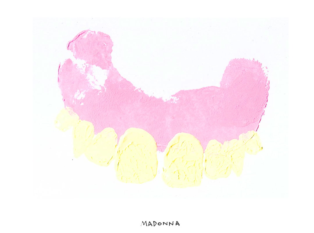 JamesO'Brien-PotatoDentures-Madonna-Art-itsnicethat.jpg